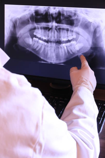 Best Orthodontic Emergency Dentist in Monon, IN