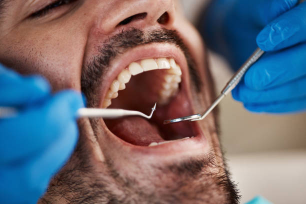 Best Emergency Dental Services for Seniors in Monon, IN
